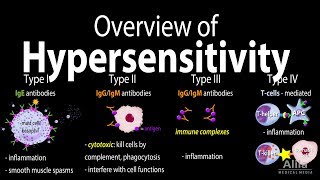 Hypersensitivity Overview of the 4 Types Animation [upl. by Gadmann]