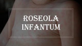 Pediatrics Infectious disease  Roseola infantum exanthem subitum [upl. by Eneleahs680]