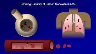 Pulmonary Function Tests PFT Lesson 4  DLCO [upl. by Lebam]