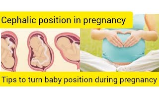 Cephalic presentation in tamilbaby positiontips to turn baby head down positionpregnancy tips [upl. by Ebocaj]