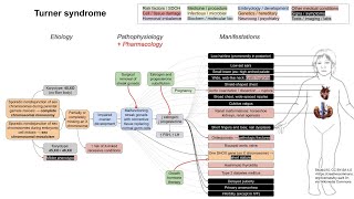 Turner syndrome mechanism of disease [upl. by Hanser302]