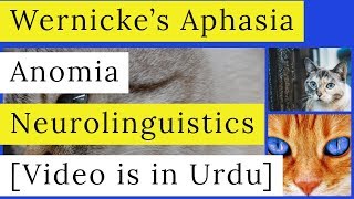 Wernickes Aphasia  Receptive Aphasia  Anomic Aphasia  Symptoms  Causes  Neurolinguistics [upl. by Alamak]