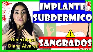 SANGRADOS con IMPLANTE SUBDERMICO ¿Por Qué ¿Qué Hacer por GINECOLOGA DIANA ALVAREZ [upl. by Elephus508]