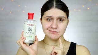 Thayers Witch Hazel Rose Petal Toner Review [upl. by Enimrej99]