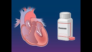 Finerenone in Heart Failure with Preserved Ejection Fraction  NEJM [upl. by Cannell900]