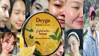 Deyga Exfoliator Scrub  Honest Review [upl. by Marshall]