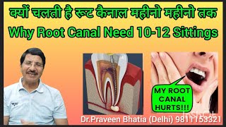 क्यों चलती रहती है रूट कैनाल महीनो तक why root canal need 10 to 12 sittingsrct rootcanaltreatment [upl. by Bergren]