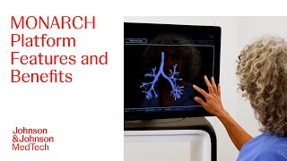 MONARCH Platform RoboticAssisted Bronchoscopy Overview  JampJ MedTech [upl. by Borreri]