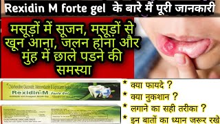 RexidinM Forte Gel  Review and Benefits  Rexidin m forte gel how to use [upl. by Erbma]