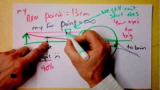 Optometry 101  Corrective Optics for Myopic and Hyperopic Vision  Doc Physics [upl. by Senoj]