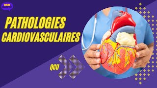 QCU en Pathologies Cardiovasculaires ‐ [upl. by Narine]