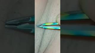 ARMPIT HAIR Extractions Using Tweezers • UNDERARM HAIR Removal • Most Satisfying Video 2021 [upl. by Airekal903]