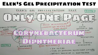 Eleks Gel Precipitation Test  Microbiology  The Charsi of Medical Literature [upl. by Hgielram]