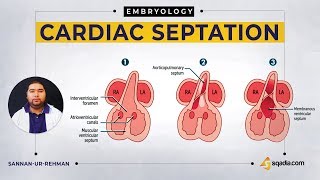 Cardiac Septation  Embryology Video Lecture  USMLE  VLearning Courses [upl. by Latea906]