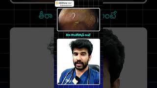 తిన్న వెంటనే మోషన్ వెళ్తున్నారా అయితే ఈ వీడియో చూడండిDrVikranth Chunduri [upl. by Llecrad239]