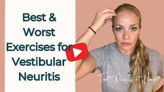 Best and Worst Vertigo Exercises for Vestibular Neuritis [upl. by Eixam]