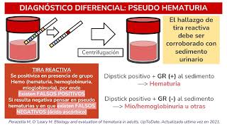 SEMIOLOGÍA  SÍNDROME HEMATÚRICO HEMATURIA [upl. by Lemaj211]