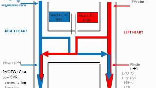 Complete Transposition of great arteries  hemodynamics amp physiology [upl. by Ahras495]