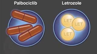 Palbociclib and Letrozole for Advanced Breast Cancer [upl. by Martreb731]