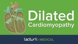 Dilated Cardiomyopathy  Cardiology [upl. by Nosnar]