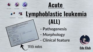 ALL Acute Lymphoblastic LeukemiaLymphoma  Disorders of White Cells  Lymphoid neoplasm Pathology [upl. by Ashlin471]