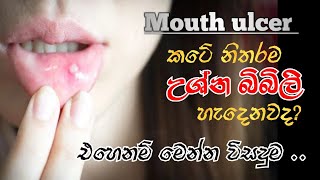 මුකයේ ඇතිවෙන උශ්න බිබිලි සදහා විසදුමHow to treat mouth ulcer [upl. by Enomrej]