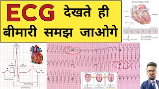 ECG Report  ECG Report Reading  ECG Report kaise Pade  Doctor  Hospital  Nursing  BHMS  BAMS [upl. by Mccord352]