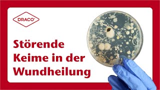 Störende Keime in der Wundheilung – der DRACO® Videoblog [upl. by Coralie352]