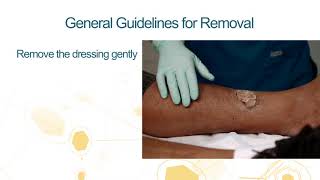 Medihoney Product Guidelines for Removal [upl. by Ayotol]