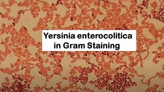 Gram Negative Rods of Yersinia enterocolitica [upl. by Heilner268]