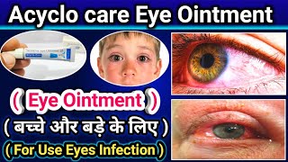 Acyclo care eye Ointment  Aciclovir Ointment use for eye infection kids amp Adult  Full Review [upl. by Sarette]