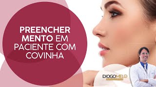 Preencher mento em paciente com covinha [upl. by Ycul753]