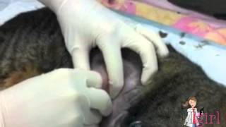 VG Abscess Video [upl. by Hedva541]