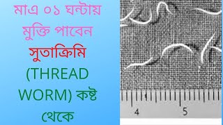 মাএ ০১ ঘন্টায় মুক্তি পাবেন সুতাক্রিমি THREAD WORM কষ্ট থেকেDrDelwar hossain [upl. by Merow]