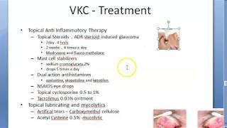 Ophthalmology 088 c Vernal KeratoConjunctivitis Spring Catarrh Treatment How [upl. by Ezmeralda229]