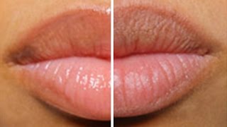 Remedios Para Labios Resecos [upl. by Analed]