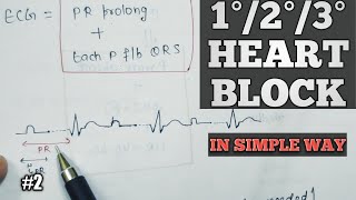 FirstsecondThird degree heart block  Cardiac arrhythmia in hindi  Av block  2 [upl. by Illib]