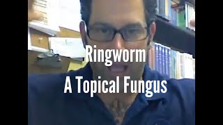 Ringworm A topical fungus [upl. by February440]