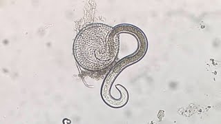 Parasitosis causada por Toxocara spp [upl. by Cymbre]