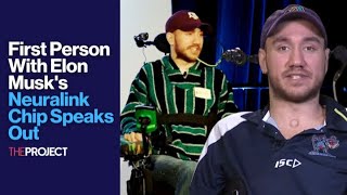 First Person With Elon Musks Neuralink Chip Speaks Out [upl. by Neelahs]