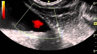 canine ureteral jets with power Doppler [upl. by Burty544]