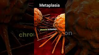 Metaplasia pharmacy cancer science shorts nursing biology [upl. by Imoin]