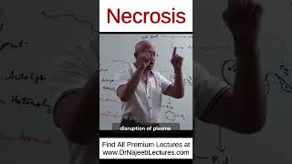 Necrosis drnajeeb drnajeeblectures shortvideo youtubeshorts [upl. by Oecile]