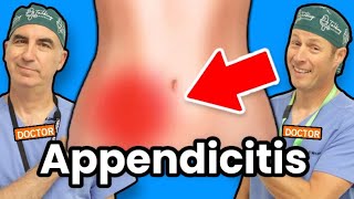 Appendicitis  How Do I Know If I Have Appendicitis [upl. by Chaunce]