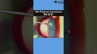 Spinal Anesthesia  How spinal is given  Epidural Anesthesia rirssurgery pregenency [upl. by Ynabla549]