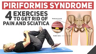 Piriformis Syndrome  Home Stretches amp Exercises [upl. by Obe573]