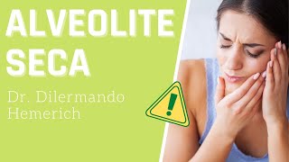 ALVEOLITE SECA  O que é [upl. by Dorr390]