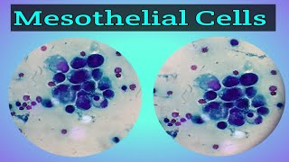 Mesothelial Cells  Pap Stain  Fluid Routine Examination  Cytology  ELearn with Technologist [upl. by Hareehahs905]