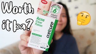 Oxecure Acne Clear Potion  WORTH IT BA Skincare Review Philippines [upl. by Aneeh516]