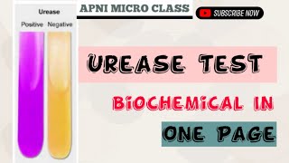 What is Urease Test  concept in Microbiology Explain in Hindi [upl. by Marleah780]